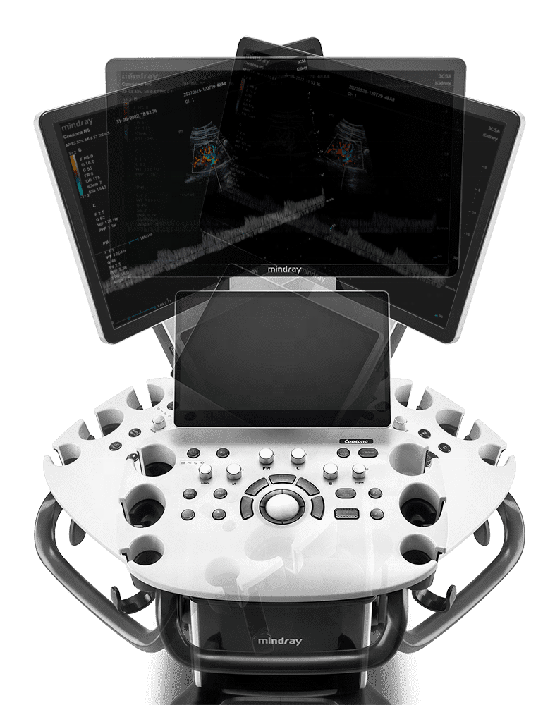 Diagnostic Ultrasound Imaging System Consona N6 3d Ultrasound