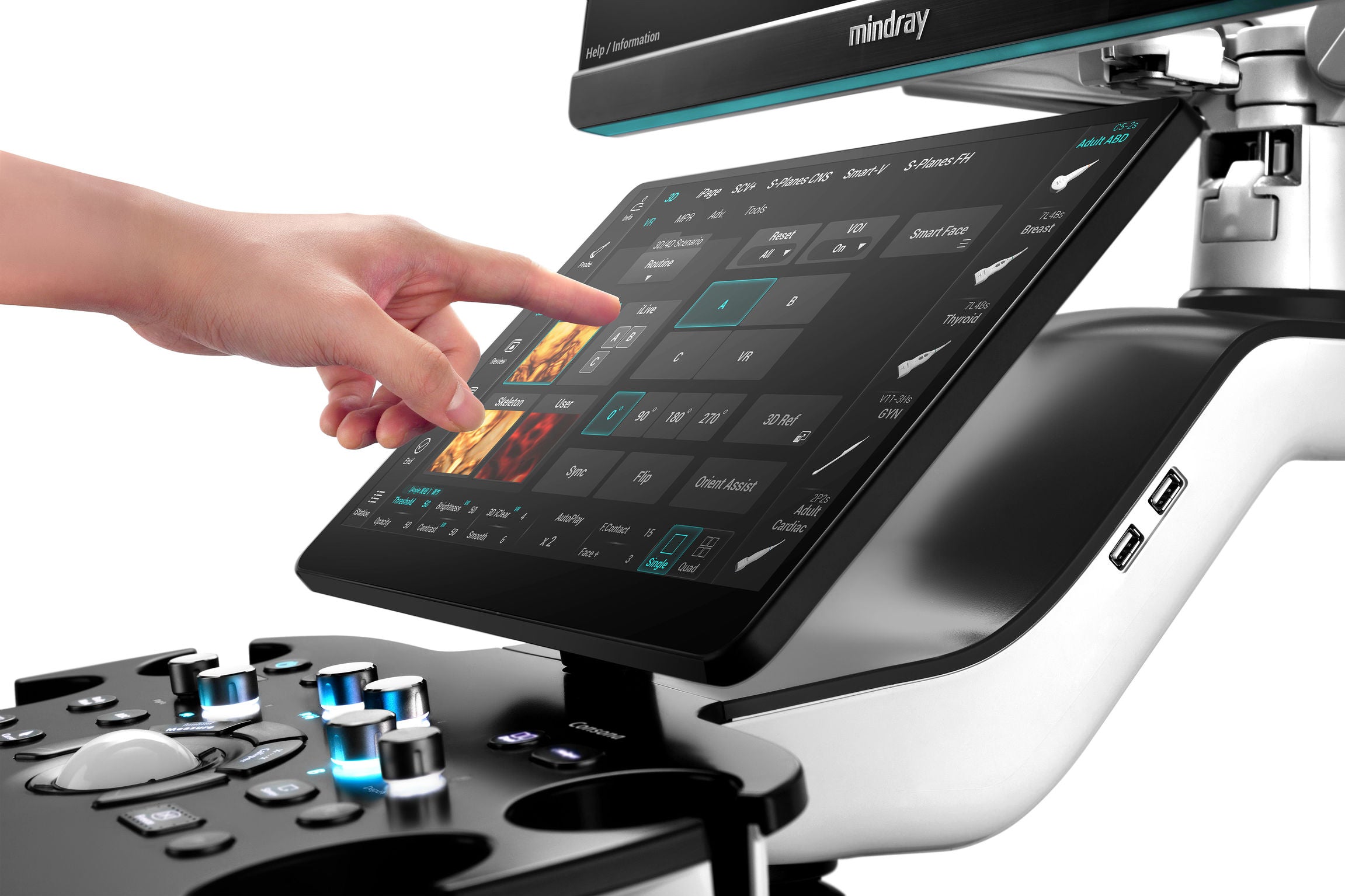 Mindray Brand Consona N9 Best Selling Quality Color Full Digital 4D Trolley Diagnostic Ultrasound System