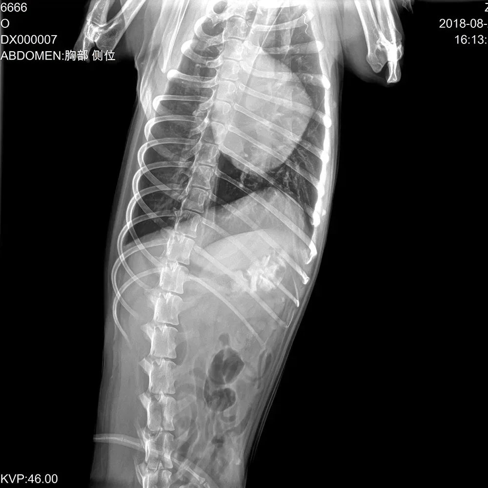 Mars 1717V High Quality Medical 17x17 inch Wireless Portable Digital X-ray Detector DR Flat Panel