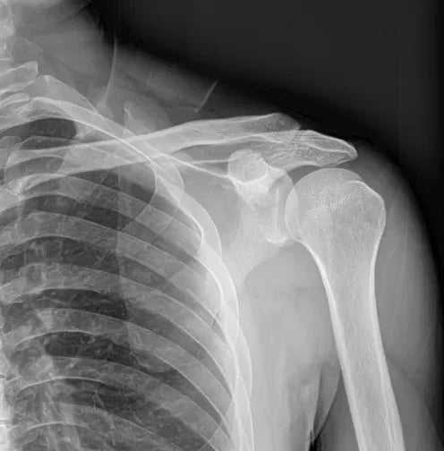 Mars 1717V High Quality Medical 17x17 inch Wireless Portable Digital X-ray Detector DR Flat Panel